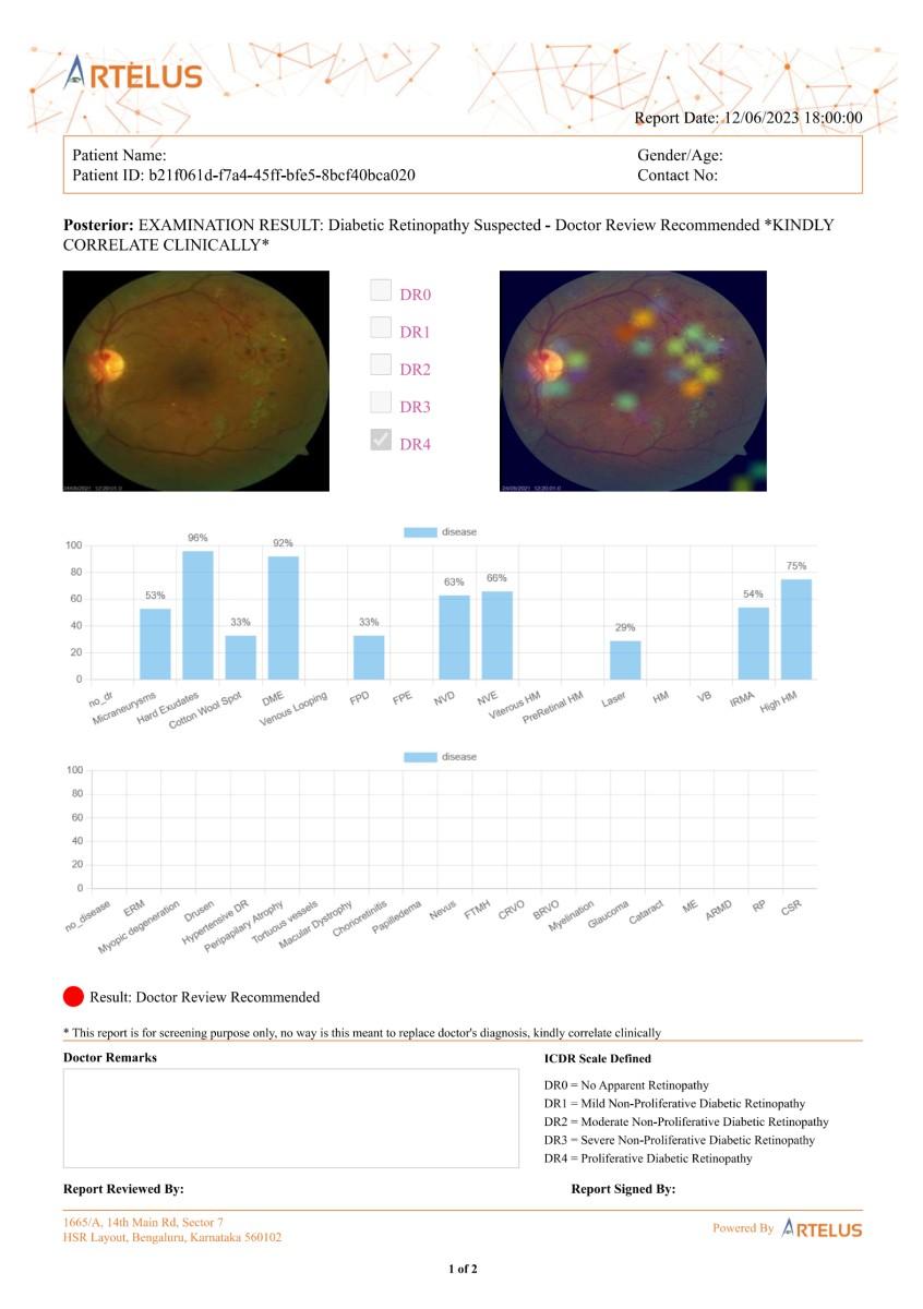 Artelus Diabetic Retinopathy Report - Fundus Image